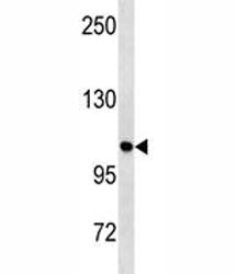 ULK1 Antibody