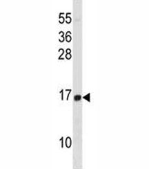 HIST1H2BD Antibody