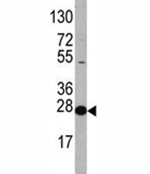 EIF4E Antibody