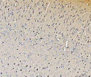 HDC Antibody / Histidine decarboxylase