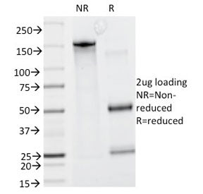 SDS-PAGE analysis of purified, BSA-free CAD antibody (clone CALD1/820) as confirmation of integrity 