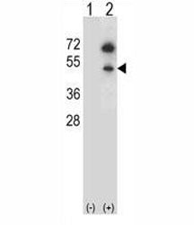 Western blot analysis of GNAS antibody and 293 cell lysate (2 ug/lane) either nontransfected (Lane 1
