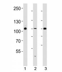 Western blot analysis of lysate from 293, HUVEC, T47D cell line (left to right) using GAB1 antibody 