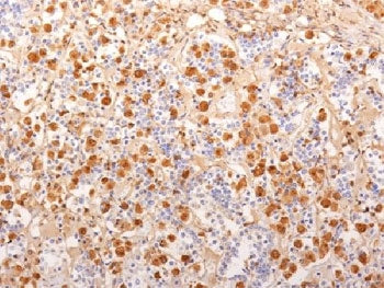 IHC testing of FFPE human pituitary gland with ACTH antibody