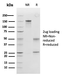 SDS-PAGE analysis of purified, BSA-free Peroxiredoxin 4 antibody (clone CPTC-PRDX4-2) as confirmatio