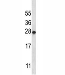 IL-22 antibody western blot analysis in K562 lysate. Observed molecular weight: 19~25kDa depending o