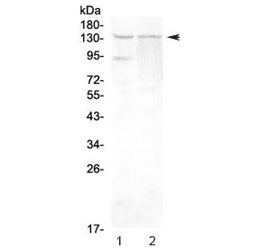 Western blot testing of rat 1) testis and 2) PC-12 lysate with RTEL1 antibody at 0.5ug/ml. Predicted