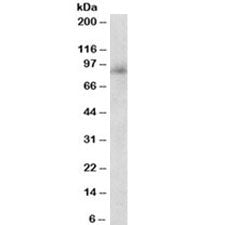 Myeloperoxidase Antibody