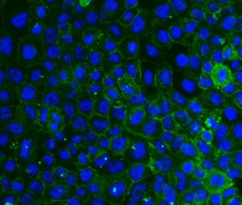 Immunofluorescent staining of FFPE human A431 cells with Integrin beta 4 antibody (green) and DAPI n