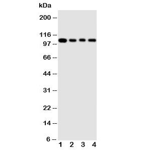 Western blot testing of HSP105 antibody and Lane 1: rat ovary ; 2: A549 cell lysate; 3: U87 cell lys