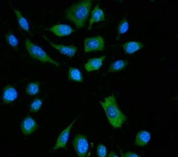 Zbp1 Antibody / Z-DNA-binding protein 1 / Dai