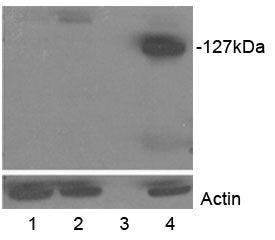 Western blot testing of transfected HEK293 lysate with Tankyrase 2 antibody at 0.5ug/ml. Lane 1: moc