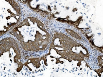 INPPL1 Antibody / SHIP2