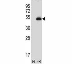 Western blot analysis of anti-PAX6 antibody and 293 cell lysate (2 ug/lane) either nontransfected (L