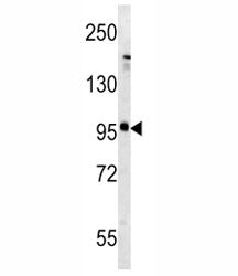 mGLUR5 Antibody