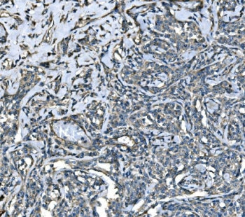 Atlastin-1 Antibody / ATL1 / SPG3A