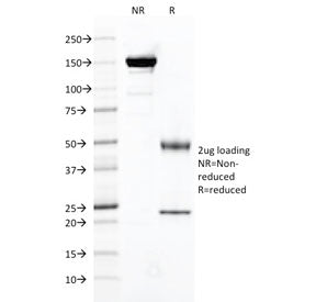Folate Hydrolase 1 Antibody / FOLH1 / PSMA