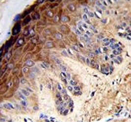 IHC testing of FFPE human skin tissue with Topoisomerase II alpha antibody. HIER: steam section in p