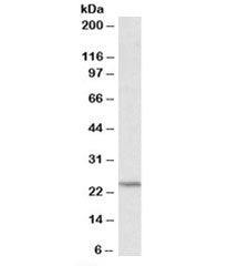 TIMP1 Antibody
