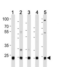 Western blot analysis of lysate from HeLa (1), HepG2 (2), Jurkat (3), mouse liver (4) , rat kidney (