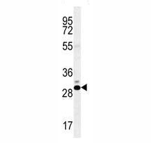 CT45A Antibody