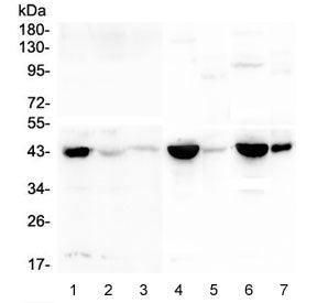 CKM Antibody / Creatine Kinase M