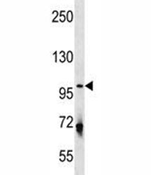 ULK1 Antibody