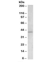 Western blot testing of human hippocampus lysate with CB2 antibody at 1.5ug/ml. Predicted molecular 