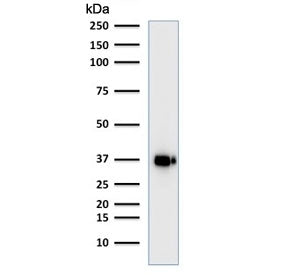 POU2AF1 Antibody / BOB-1