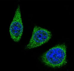 MMP7 Antibody