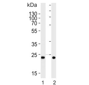 Western blot testing of 1) human ovary and 2) mouse testis tissue lysate with MitoPLD antibody. Pred