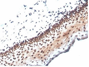 IHC staining of FFPE human cervix tissue with NME1 antibody (clone NME1/2737). HIER: boil tissue sec