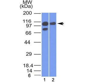 Western blot testing of human 1) A431 and 2) MCF7 cell lysate with Alpha Catenin antibody (clone 1G5