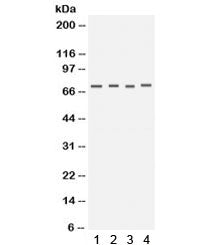 Western blot testing of human 1) HeLa, 2) COLO320, 3) HT1080 and 4) PANC cell lysate with Kv1.4 anti