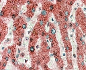 HRASLS2 Antibody