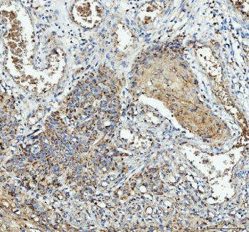 IL1RA Antibody / Interleukin-1 Receptor Antagonist