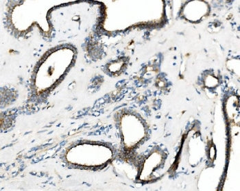 PRKG1 Antibody / cGKI