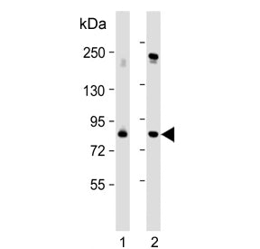 PLK2 Antibody / Polo-like kinase 2 / SNK