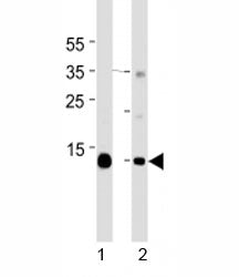 Western blot analysis of lysate from mouse 1) heart and 2) skeletal muscle tissue lysate using Myogl