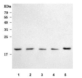 Western blot testing of 1) human SH-SY5Y, 2) human U251, 3) human HepG2, 4) human Caco-2 and 5) rat 