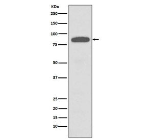 IKK alpha/beta Antibody