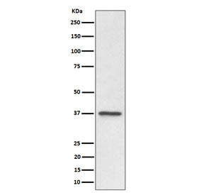 Western blot testing of human U-87 MG cell lysate with C3orf38 antibody. Predicted molecular weight ~37 kDa.