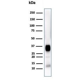 Western blot testing of human Jurkat cell lysate with CD7 antibody (clone CD7/3868R). Expected molec