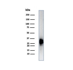 Western blot testing of human testis tissue lysate using Calbindin 2 antibody (clone CALB2/7029R). P