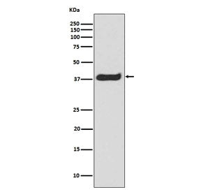 LAT Antibody / Linker for Activation of T cells (pY191)