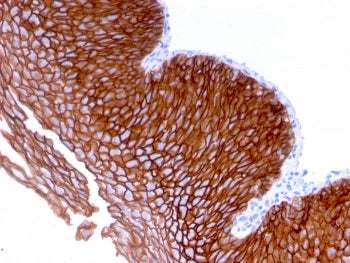 Desmoglein 3 Antibody / DSG3