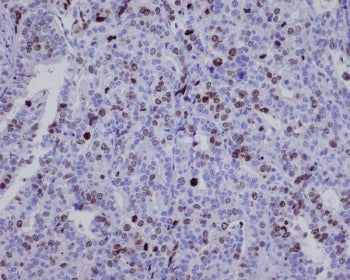 Survivin Antibody / BIRC5