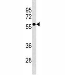 CD1a Antibody
