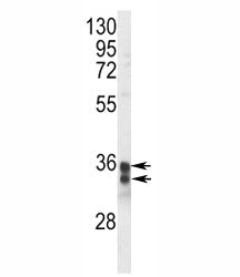 Western blot analysis of STING antibody and Jurkat lysate. Predicted molecular weight ~42/35 kDa, ob