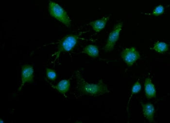 Immunofluorescent staining of FFPE human RM-1 cells with Death-associated protein kinase 3 antibody 